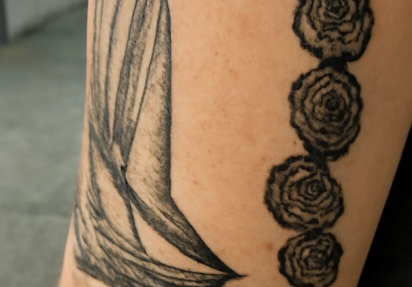 Is it normal for tattoos to peel and why do tattoos peel